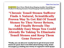 Go to: Tonsil Stones! *up To $22/sale* New Vsl!