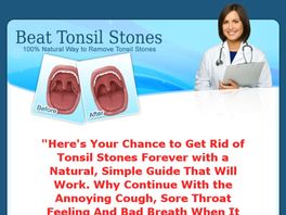 Go to: Beat Tonsil Stones- 100 % Natural Way To Remove Tonsil Stones