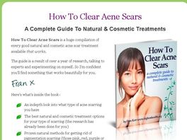 Go to: How To Clear Acne Scars