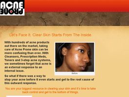 Go to: Acne Prone, 5 Steps To Clear Skin Starting From Within
