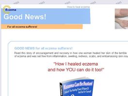 Go to: Eczema Can Be Beaten - 30 Days To Great Skin