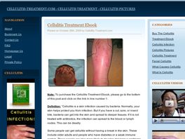 Go to: Cellulitis Treatment