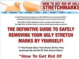 Go to: How To Get Rid Of Ugly Stretch Marks