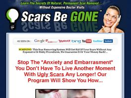 Go to: Scars Be Gone - #1 Rated Scar Removal Program