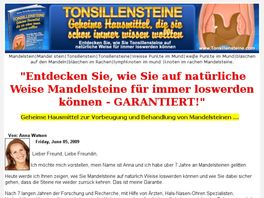 Go to: Mandelsteine - Tonsillensteine - Tonsil Stones Remedies